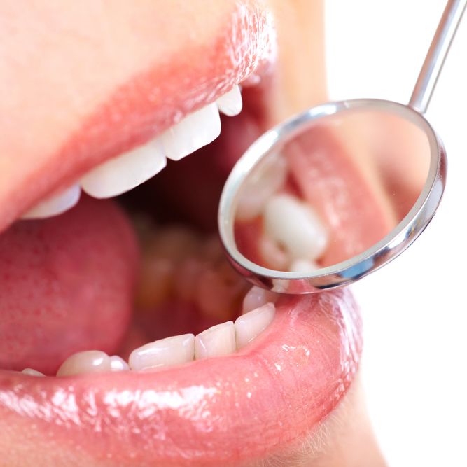 Dental exam tools